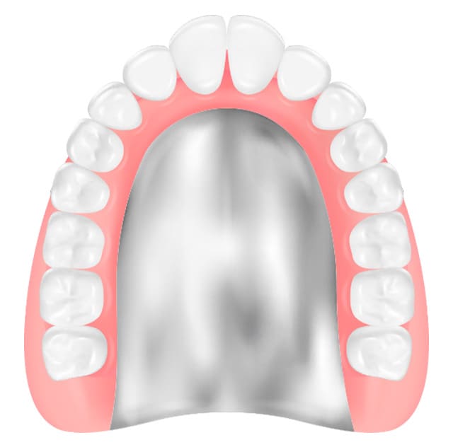 コバルトクロム床義歯