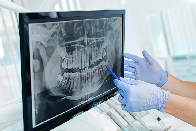 レントゲン写真で説明してる医師